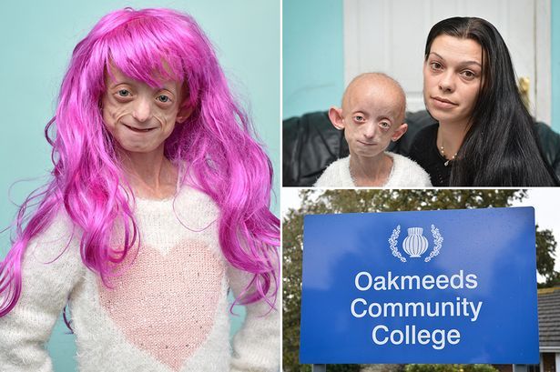 Učiteľ nariaďuje umierajúcemu dievčaťu, ktoré trpí alopéciou, odstrániť parochňu, pretože má nesprávnu farbu